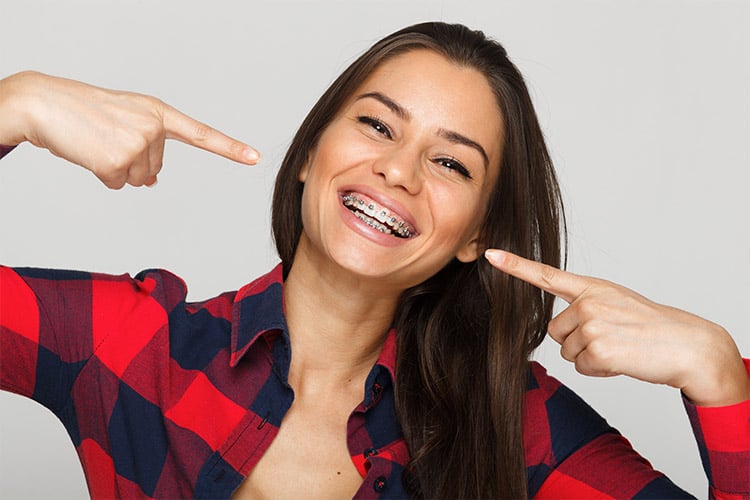 Metal braces